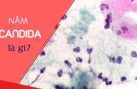 Nấm Candida là gì? Nấm Candida có nguy hiểm không?